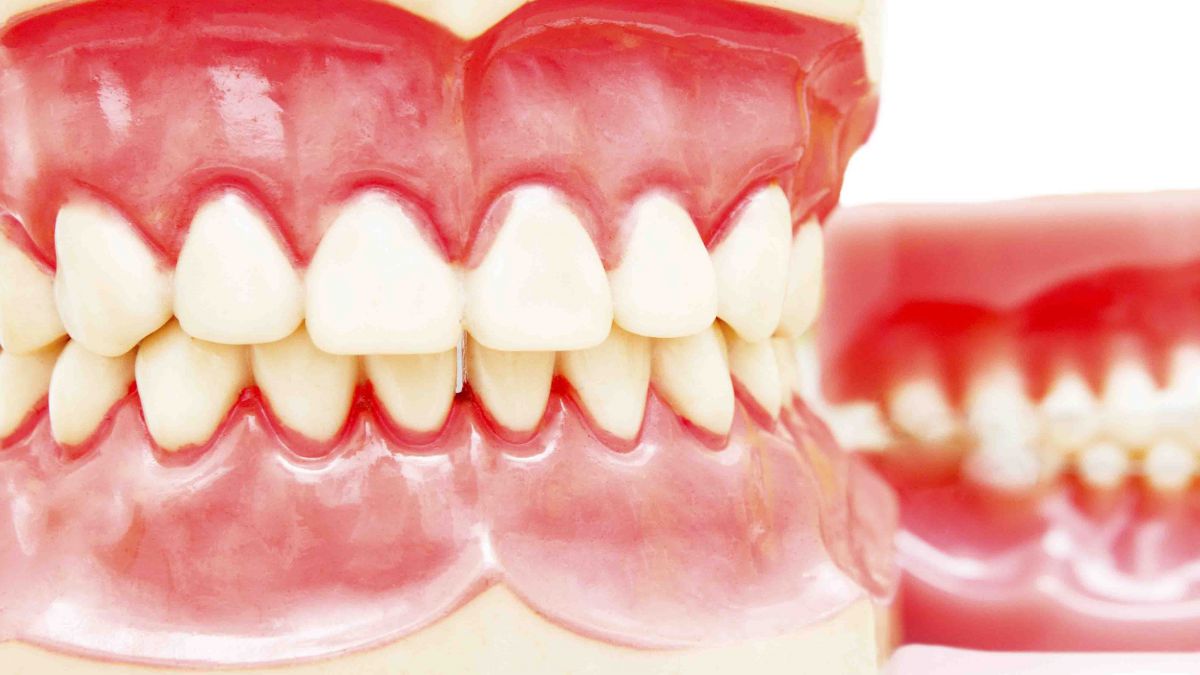 PRUEBA LIBRE - TECNICO SUPERIOR EN PROTESIS DENTALES