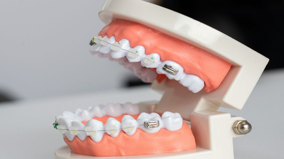 TECNICO SUPERIOR EN HIGIENE BUCODENTAL