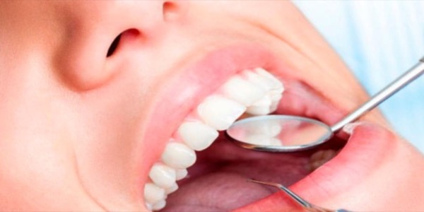 Curso de Técnico Superior en Higiene Bucodental
